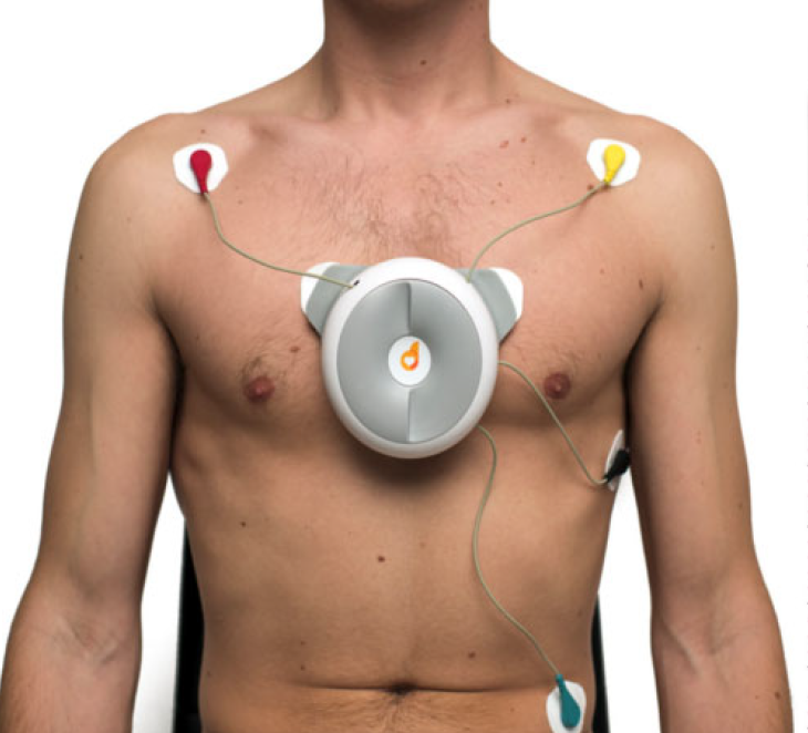 D-Heart Smartphone ECG Device